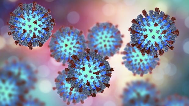 Southern Alberta’s 472 affirmation of measles instances ‘Tip of Noknsburg,’ Well being Officer says Southern Alberta’s 472 affirmation of measles instances ‘Tip of Noknsburg,’ Well being Officer says