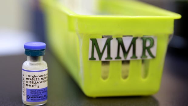 Canada done measles eradication in 1998. Now, it may well lose it Canada done measles eradication in 1998. Now, it may well lose it