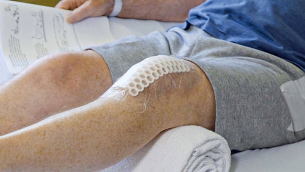 If there’s a central ready record then it is vitally sharp to reach the alternative of the hip or knee: learn about If there’s a central ready record then it is vitally sharp to reach the alternative of the hip or knee: learn about