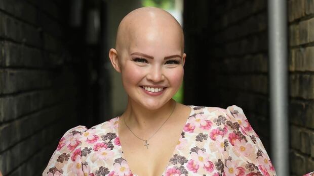 What ladies will have to find out about hair loss What ladies will have to find out about hair loss