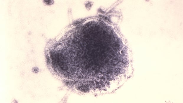 Ontario reported in additional than 170 new measles circumstances, introduced as much as about 1,800 Ontario reported in additional than 170 new measles circumstances, introduced as much as about 1,800