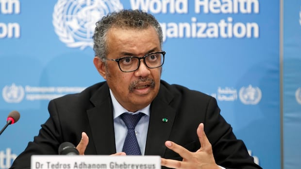 World epidemic settlement followed us amid absence World epidemic settlement followed us amid absence