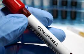 England is starting a gonorrhea vaccine.