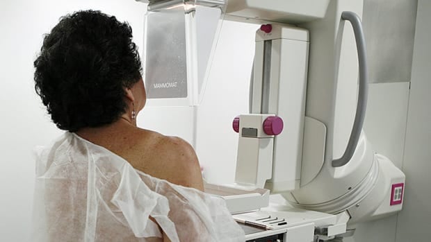 Major overhaul ordered for a group setting Canadian cancer screening guidelines Major overhaul ordered for a group setting Canadian cancer screening guidelines