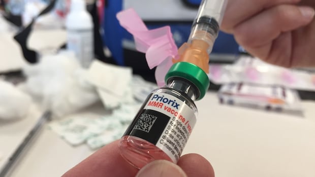 710 measles cases have now been confirmed in Alberta, it is the worst year since 1986. 710 measles cases have now been confirmed in Alberta, it is the worst year since 1986.