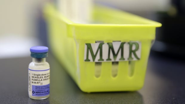 Alberta’s measles outbreak reported to the top case reported to the whole of America Alberta’s measles outbreak reported to the top case reported to the whole of America