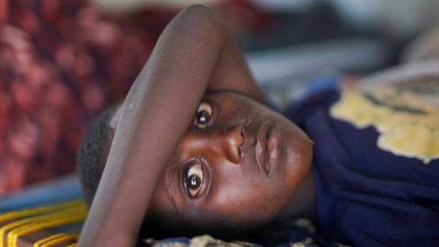 Water is not safe for drinking water in Sudan in war. But people have no option